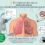 Spirometriseis Lagkadas